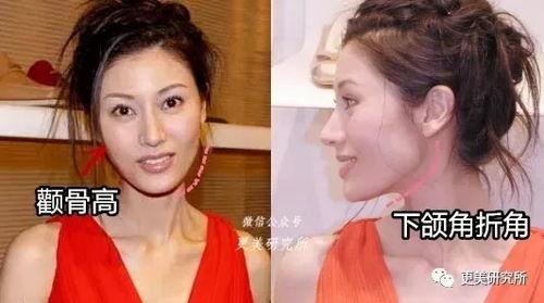 港星爆料大咖整容视频,大咖整容内幕大揭秘  第3张